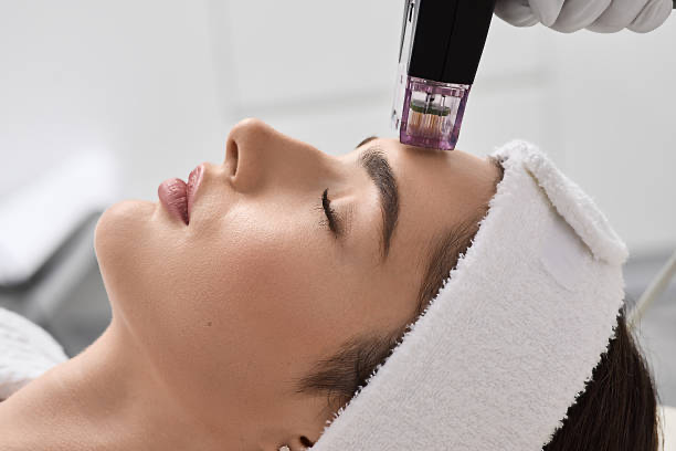 Microneedling RF
