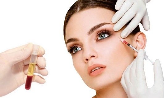 PRP : Vampire Facelift